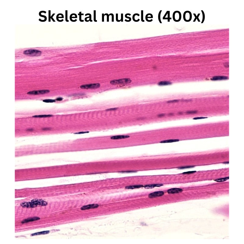 Human histology prepared slides skeletal muscle 400x maginfication